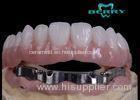 High Retention Bar Attachment Metal Based Dentures For Comestic Defects Implants