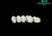 High Noble Palladium Silver PFM Dental Crown without discoloration