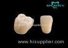 Ultra-streng and Beautiful Ceramic Crown For Teeth Cercon CAD Zirconia