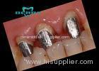 Precious Dental PFM Crown Palladium Silver Dental Post and Core