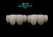 Full Ceramic Crowns and Bridge Nature and safe Asthetic restorating