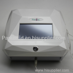 most popular and painless 30MHz radio frequency spider veins vascular veins varicose veins removal machine