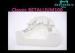 Keep Glossy Metal Framework Partial Denture With High Polishing Surface