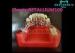 False Teeth Dentures Cast Partial Framework High Antibiosis Excellent Fracture Resistance