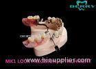 MK1 Custom Precision Attachment Dentures Excellent Retention Co-Cr Material