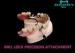MK1 Custom Precision Attachment Dentures Excellent Retention Co-Cr Material