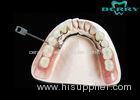 Lock Dental Attachments Dentures Teeth With Strong Corrosion Resistance