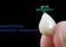 Porcelain Teeth Veneers Natural Tooth Appearance Exalted Cicada-Wings