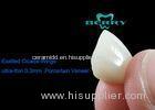 Porcelain Teeth Veneers Natural Tooth Appearance Exalted Cicada-Wings