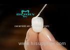 FDA Stronger Dental Veneers Gum Tissue Tolerates Porcelain Well