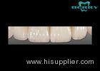 Anterior Tooth 0.6MM Ceramic Veneer IPS. E.MAX Ceram Good Biocompatibility