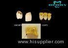 Ultra-hard Yellow Gold PFM Dental Crown High Intensity safe and health