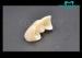 Popular and Favorable Ceramic Dental Crowns UPCERA Zir Solid Zirconia