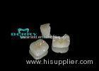 Strong Dental Inlays Restorate for tooth small damage ISO9001/2000