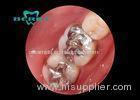 White Gold Alloy Dental Inlays Distinguished Biocompatible Tough