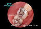 White Gold Alloy Dental Inlays Distinguished Biocompatible Tough