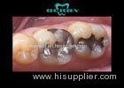 Distinguished Biocompatible Tough Palladium-Silver Alloy Porcelain Inlays And Onlays