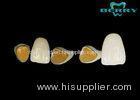 Unique and Luxury Gold composite Captek Naogold crowns restoration