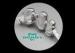 White Gold Material Telescopic Bridge Precision Attachment Type