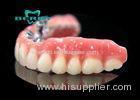 Precision Attachment Telescopic overdenture Palladium-Silver