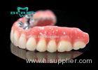 Precision Attachment Telescopic overdenture Palladium-Silver