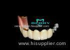 Precision Attachment Telescopic overdenture Yellow Gold Material