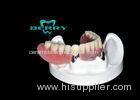 ISO9001/2001 Telescope Crowns retention partial removable denture
