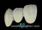 Precious Ultra-hard High Noble White Gold types of Dental Implant Crown