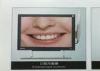 Video Endoscope System Endoscopy Equipment Camera For Dental Treatment