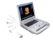 cheap PC Based 3D/4D Laptop Ultrasound B scanner/ultrasonic equipments
