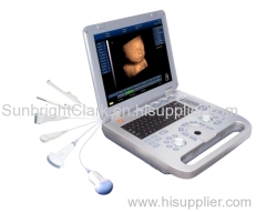3D/4D laptop B/W ultrasound/advanced hand-carried 4D ultrasound with WIN7 operation system/64G RAM 4D ultrasound