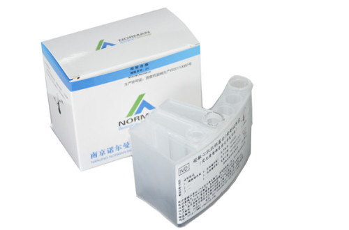 Chemiluminescencnt immunoassay for N-terminal pro-brain natriuretic peptide (NT -proBNP)