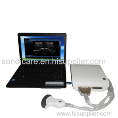 Aniaml sonography ubox/Magic Ultrasound BOX Scanner/USG BOX/ Echo sonography/ CE ultrasonic machine/high-tech usg