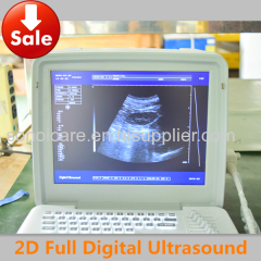 Veterinary 12LED Portable Scanner/USG machine/ Echo sonography/ CE ultrasonic machine/high-tech usg/8kgs handheld ultra