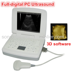 PC and 3D ultrasound scanner