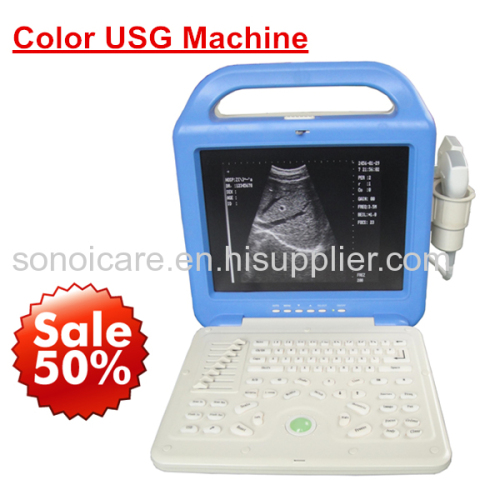 Laptop Ultrasound Scanner with CE