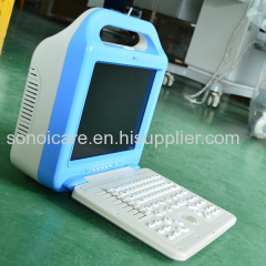 Powerful USG Machine/Handheld Ultrasound Scanner/ CE Ultrasonic Machine/ISO Echo Device/ Sonography Ultra sonic Machine