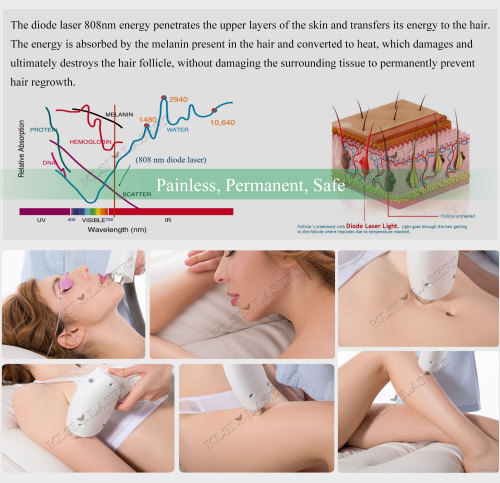 Hot sale professional laser hair removal beauty equipment from KLSi