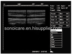 CE approved Notebook Ultrasound Scanner/USG Machine/Echo sonography/15inch Ultra sound Device