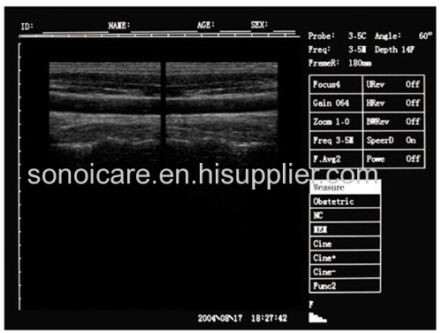VET-use CE approved Notebook Ultrasound Scanner/USG Machine/Echo sonography/15inch Ultra sound Device