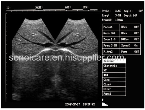 VET-use CE approved Notebook Ultrasound Scanner/USG Machine/Echo sonography/15inch Ultra sound Device