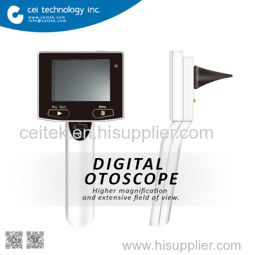 Digita Portable Video Otoscope