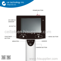 Digita Portable Video Otoscope