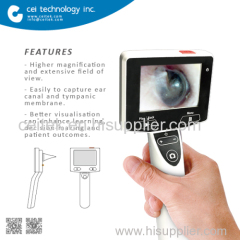 Digita Portable Video Otoscope