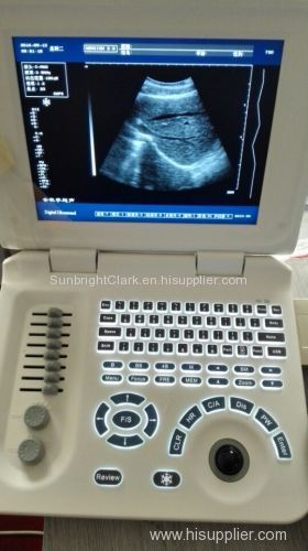 cheap small size laptop battery ultrasound scanner