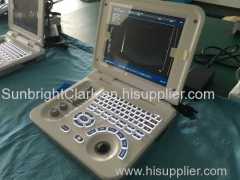 cheap small size laptop battery ultrasound scanner