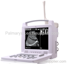 Portable Ultrasound Machine and Ultrasound Scanner and Ultrasound Device