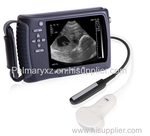 Veterinary Handheld Digital Ultrasound Scanner