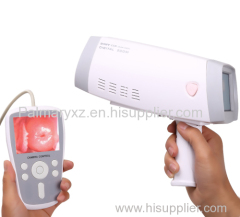 Handheld Full Digital Colposcope Machine