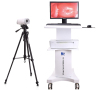 Digital Electronic Trolley Video Colposcope